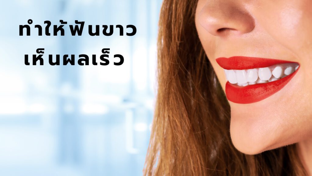 ทำให้ฟันขาวเห็นผลเร็ว